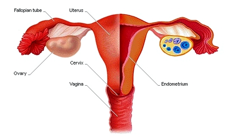 Endometriosisjpg